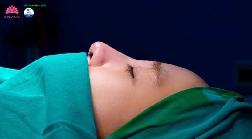 Nâng mũi tại Thẩm mỹ Bệnh viện Hồng Ngọc