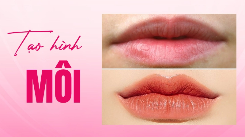 tạo hình môi