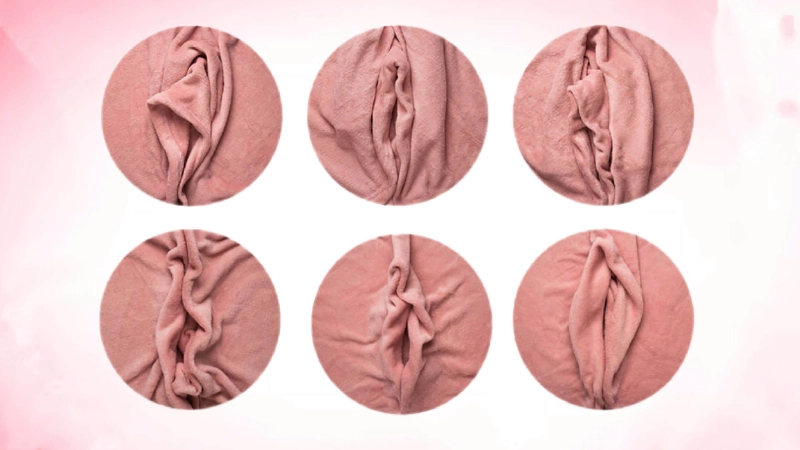 tạo hình môi bé