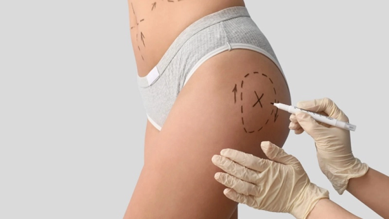 tây nghề bác sĩ nâng mông