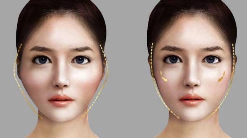 ha-go-ma-bi-kip-giup-khuon-mat-tre-trung-hơn