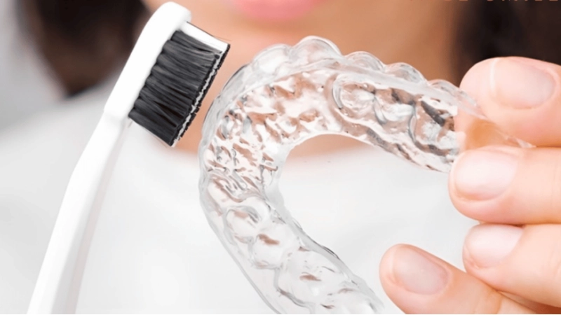 nieng-rang-invisalign-giai-phap-tham-my-toi-uu-cho-nguoi-ban-ron