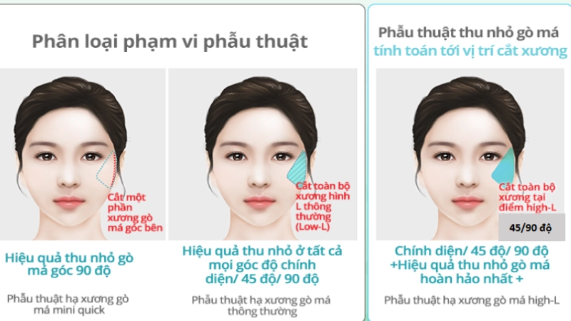 ha-go-ma-bi-kip-giup-khuon-mat-tre-trung-hon