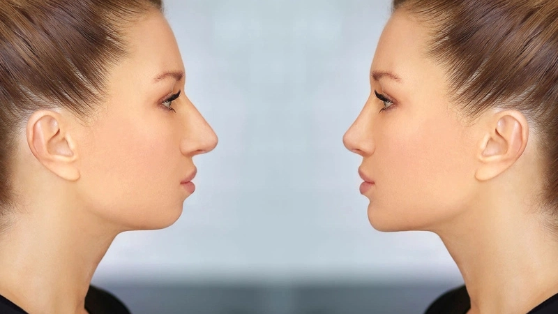 truot-ham-giai-phap-cai-thien-khop-can-va-hai-hoa-khuon-mat