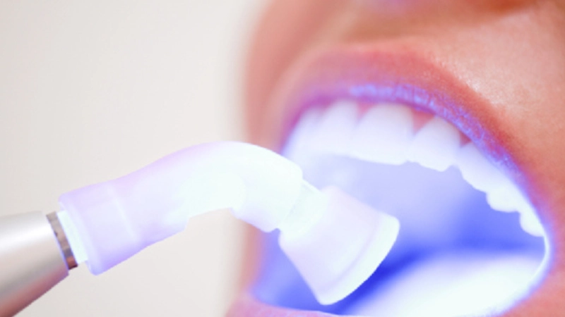 tay-trang-rang-bi-quyet-cho-nu-cuoi-tu-tin-trang-sang