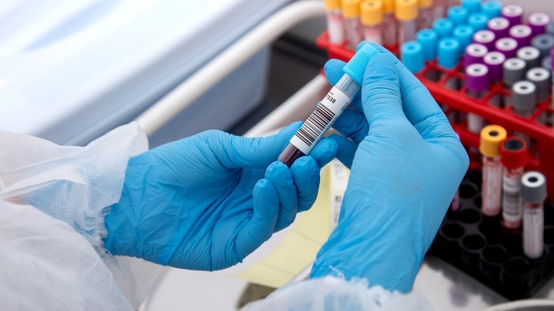 ha-go-ma-bi-kip-giup-khuon-mat-tre-trung-hon