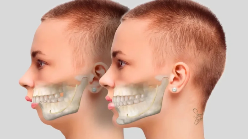 chinh-hinh-ham-ho-giai-phap-toan-dien-cho-guong-mat-hoan-hao