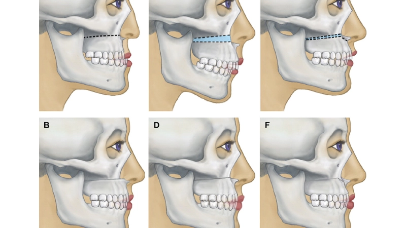 chinh-hinh-ham-ho-giai-phap-toan-dien-cho-guong-mat-hoan-hao
