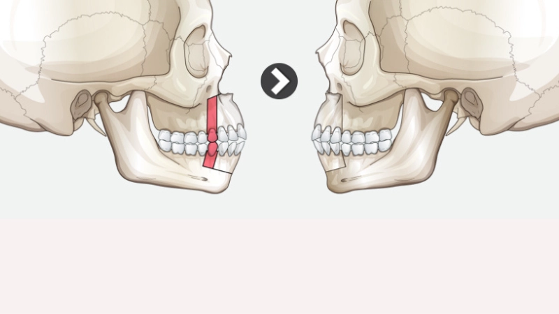 chinh-hinh-ham-ho-giai-phap-toan-dien-cho-guong-mat-hoan-hao