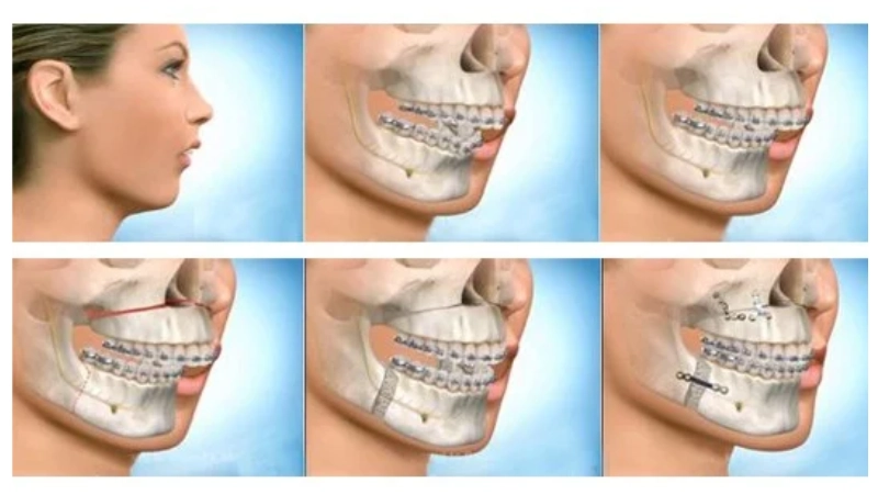 chinh-hinh-ham-ho-giai-phap-toan-dien-cho-guong-mat-hoan-hao