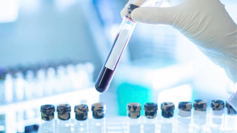 got-ham-v-line-tai-dinh-hinh-khuon-mat-chuan-ti-le-vang