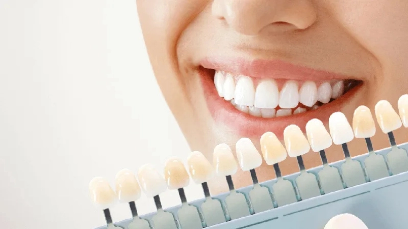 tay-trang-rang-bi-quyet-cho-nu-cuoi-tu-tin-trang-sang