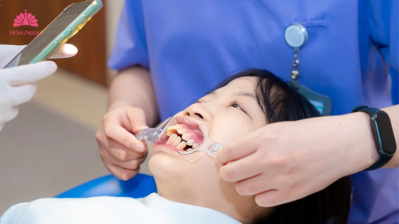 chinh-hinh-ham-ho-giai-phap-toan-dien-cho-guong-mat-hoan-hao