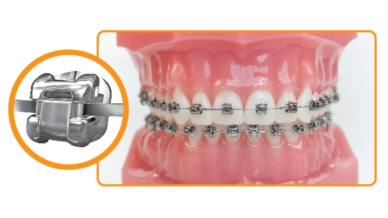 nieng-rang-tre-em-thoi-diem-vang-de-co-ham-rang-khoe-dep