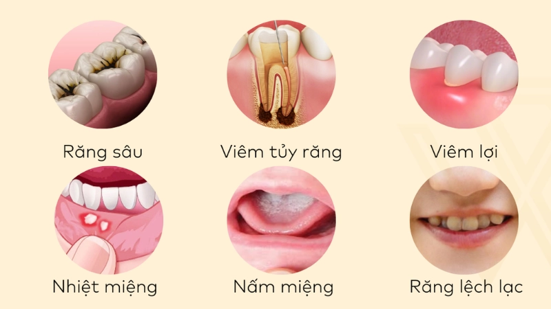 rang-ham-mat-hong-ngoc-noi-cham-soc-bao-ve-nu-cuoi-tre-tho