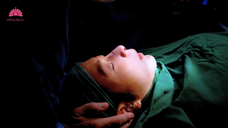 tạo hình đầu mũi