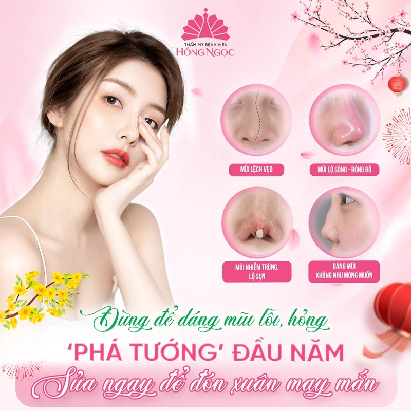 tình trạng mũi lệch là gì