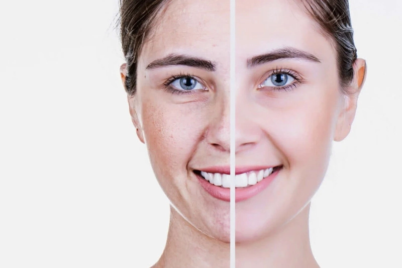 trẻ hóa da mặt là gì