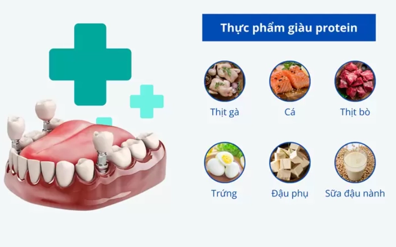 Trồng răng implant nên ăn gì?