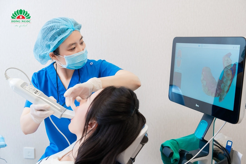trường hợp răng hô nên niềng