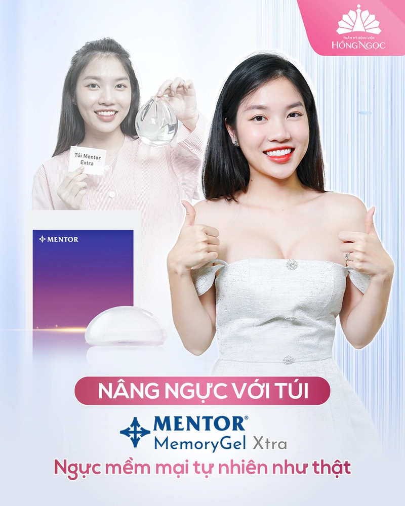 túi ngực mentor xtra